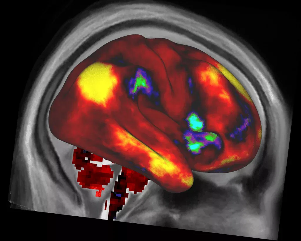 effects of cannabinoids on the brain